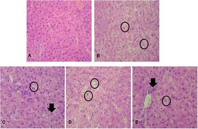 Prebiotic and Synbiotic Modifications of Beta Oxidation and Lipogenic Gene Expression after Experimental Hypercholesterolemia in Rat Liver